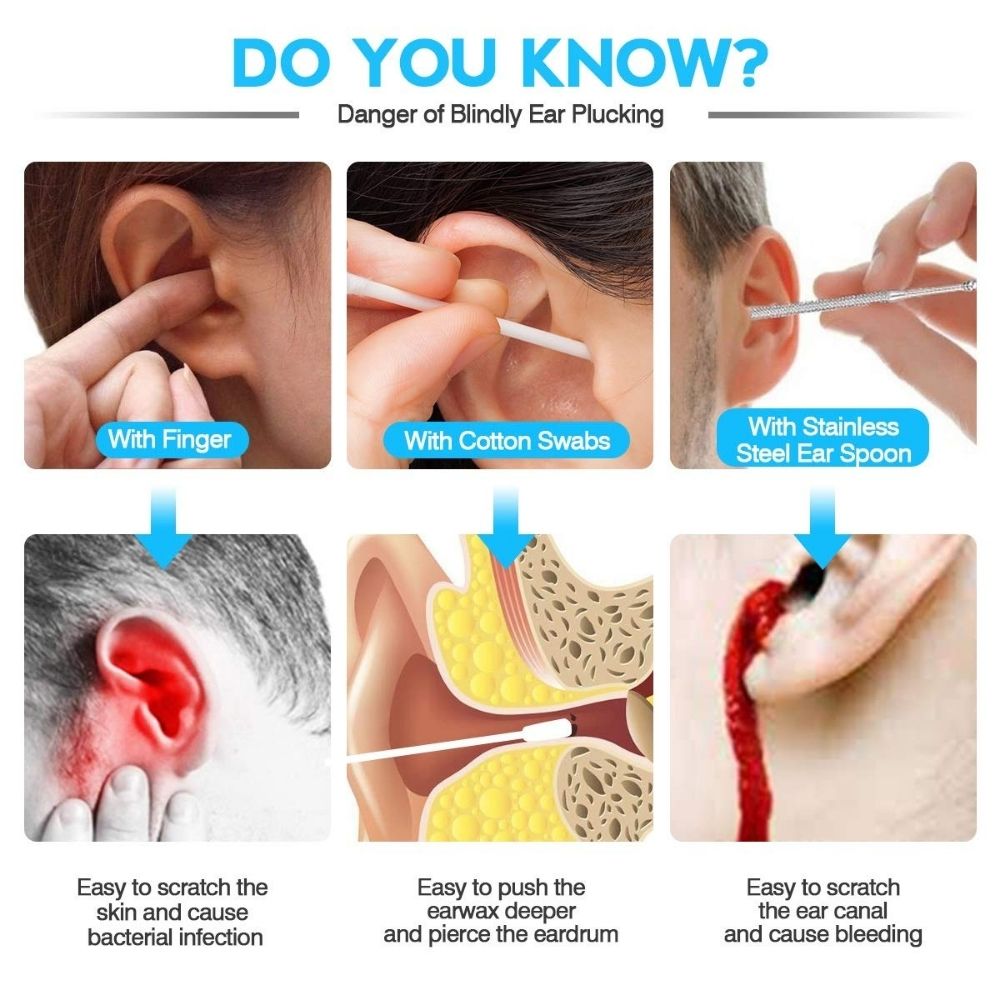 Ear Wax Removal Cleaner | Ear Cleaner Otoscope: image 6